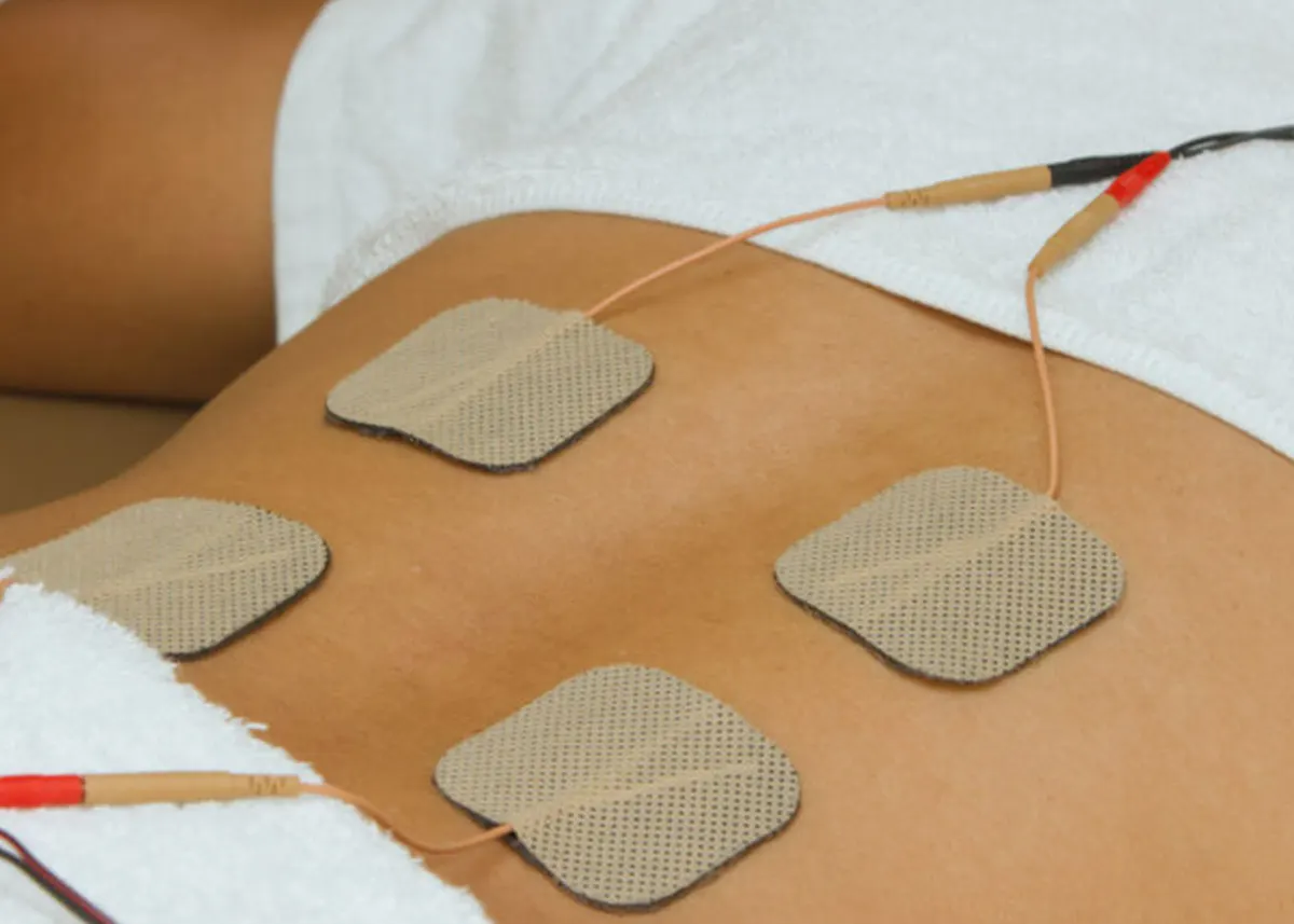 Electrical stimulation pads applied to a patient
