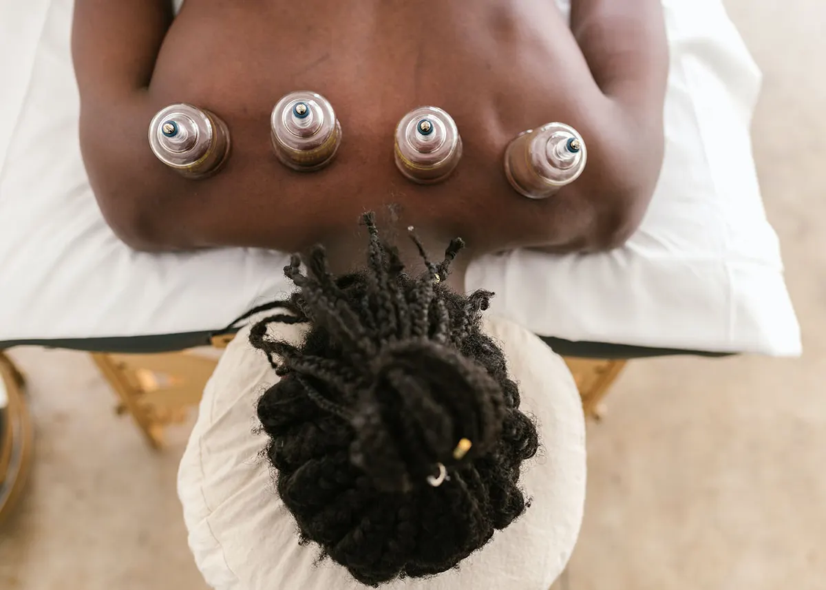 Cupping therapy cups placed on a patient’s back
